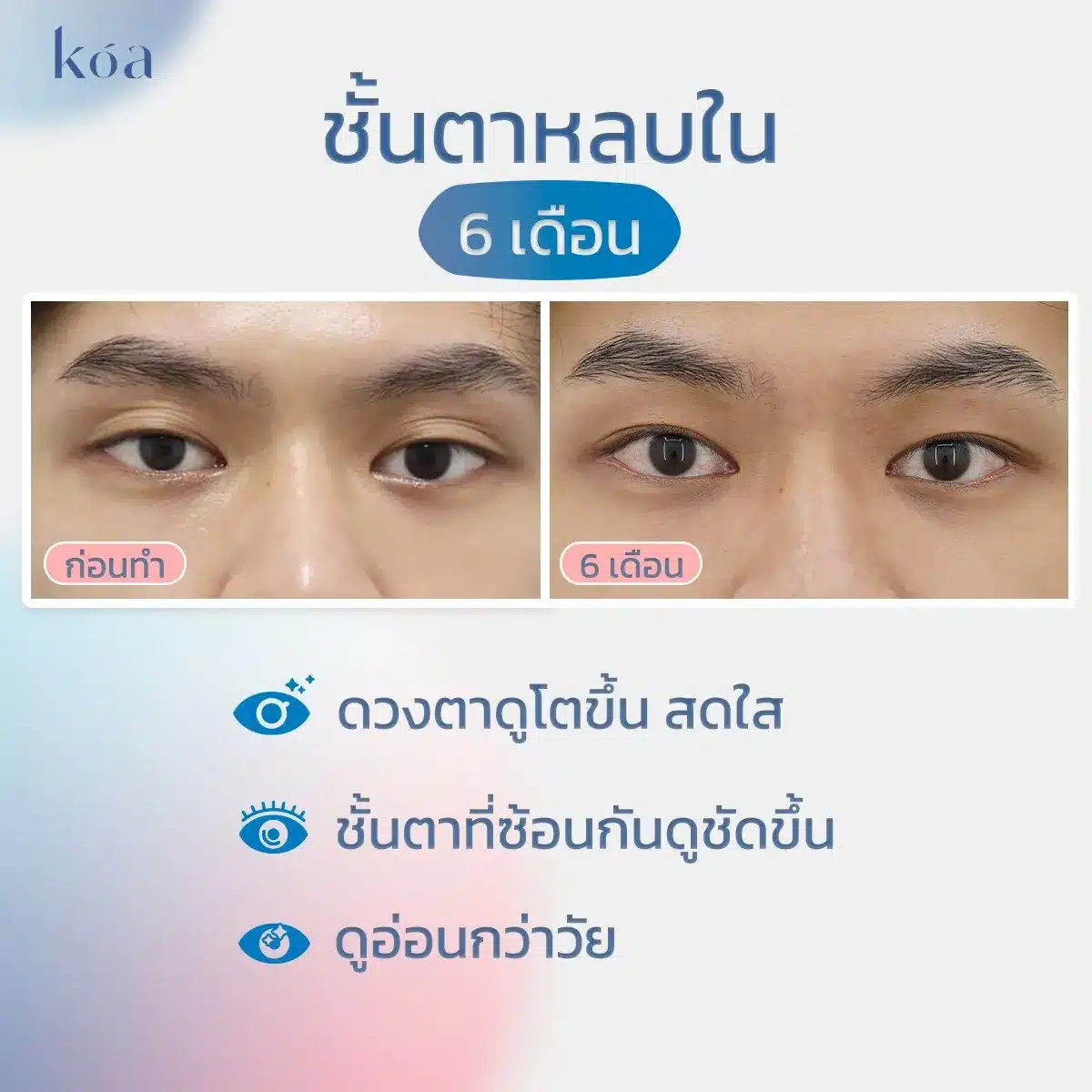 ทำตาสองชั้นหลบใน