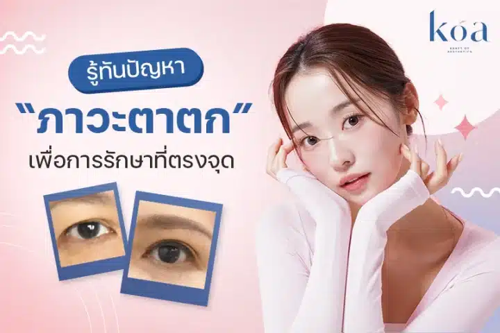 แก้ตาตก koa clinic