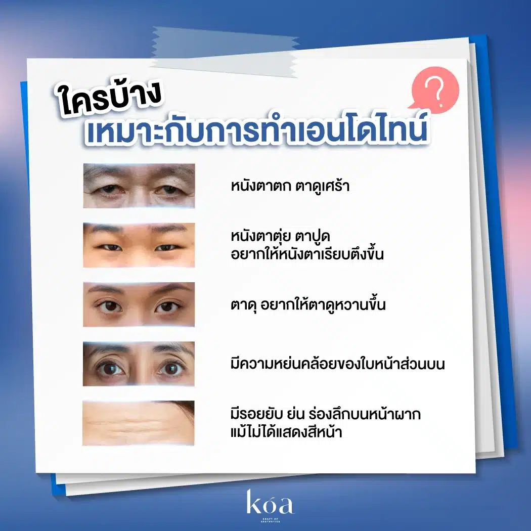 ใครบ้างที่เหมาะกับการทำเอนโดไทน์